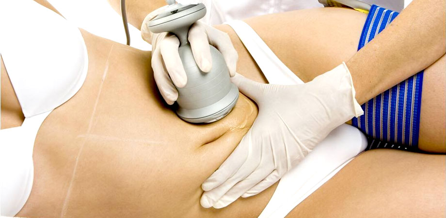 Saiba como perder barriga com tratamento estético